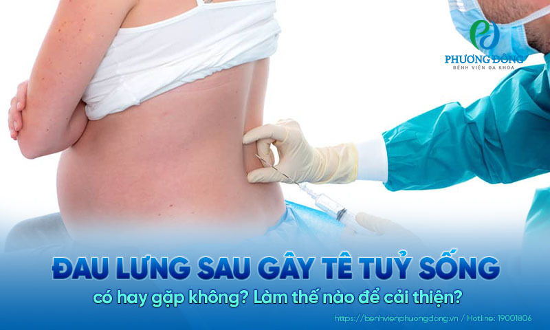 Đau lưng sau gây tê tuỷ sống có hay gặp không? Làm thế nào để cải thiện?