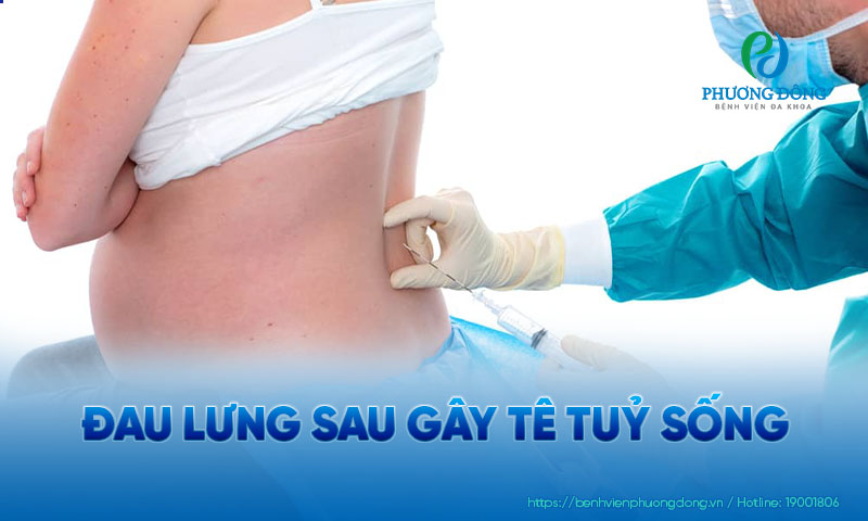Sau gây tê tuỷ sống người bệnh có thể cảm thấy bị đau lưng