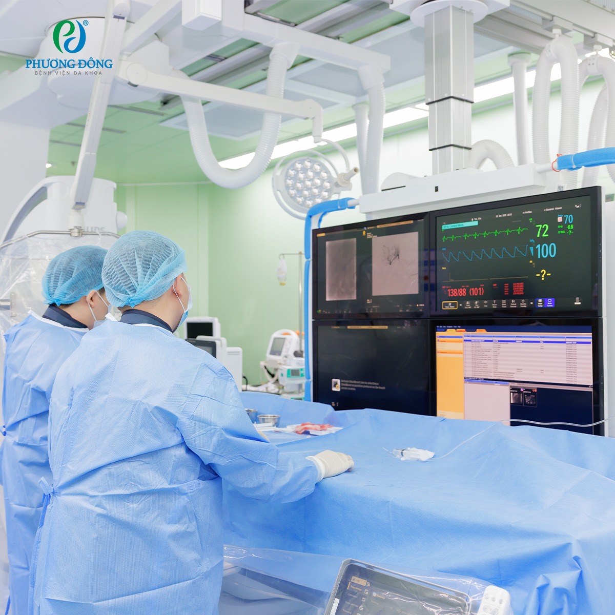 Can thiệp nút mạch điều trị u cơ mỡ mạch thận – Giải pháp an toàn, bảo tồn tối đa nhu mô thận Can thiệp nút mạch điều trị u cơ mỡ mạch thận – Giải pháp an toàn, bảo tồn tối đa nhu mô thận