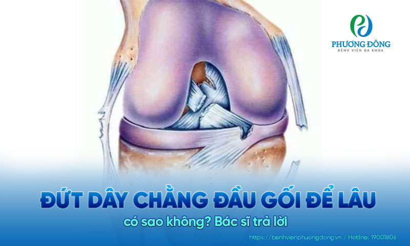 Bác sĩ trả lời: Đứt dây chằng đầu gối để lâu có sao không?