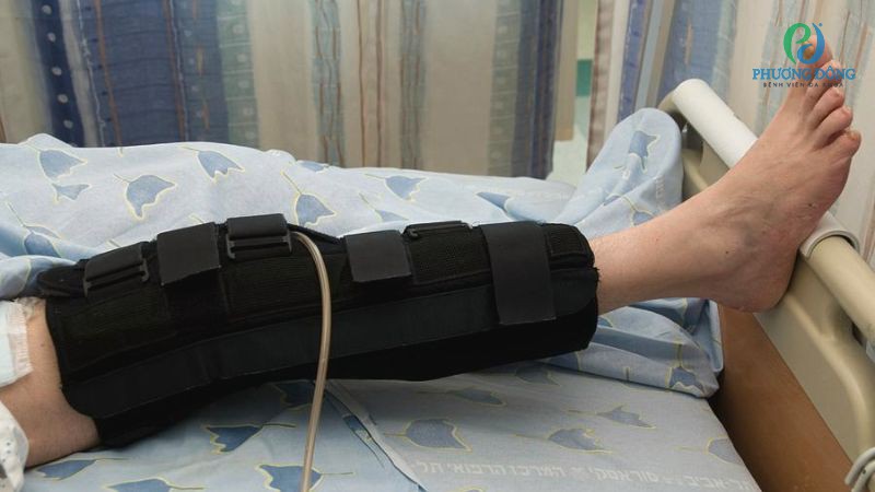 Hướng điều trị bảo tồn đối với trường hợp rách nhẹ, rách bán phần