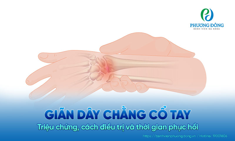 Giãn dây chằng cổ tay: Triệu chứng, cách điều trị và thời gian phục hồi
