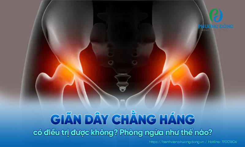 Giãn dây chằng háng có điều trị được không? Phòng ngừa như thế nào?