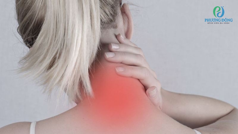 Dấu hiệu nhận biết đốt sống cổ bị hẹp lỗ liên hợp