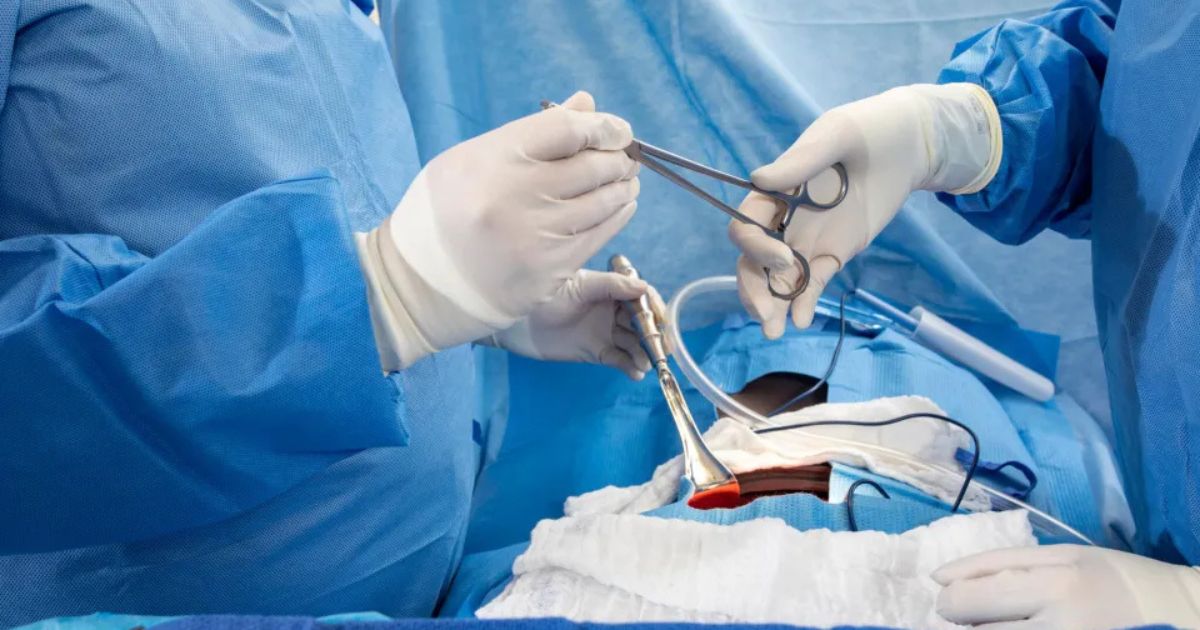 Can thiệp ngoại khoa được thực hiện trường hợp đã dùng thuốc nhưng không hiệu quả