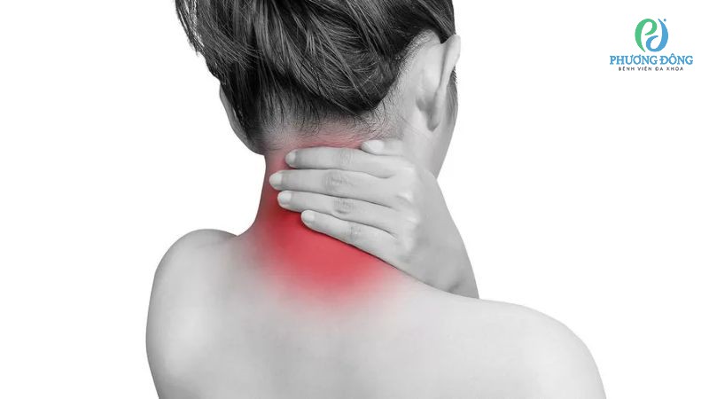 Đau cổ liên tục cảnh báo tình trạng lỗ liên hợp bị chít hẹp