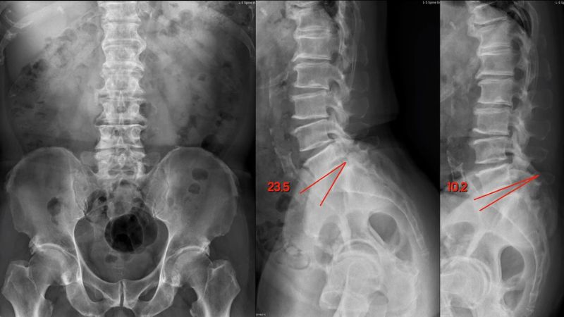 Người bệnh có thể phải chụp X Quang để hỗ trợ chẩn đoán bệnh