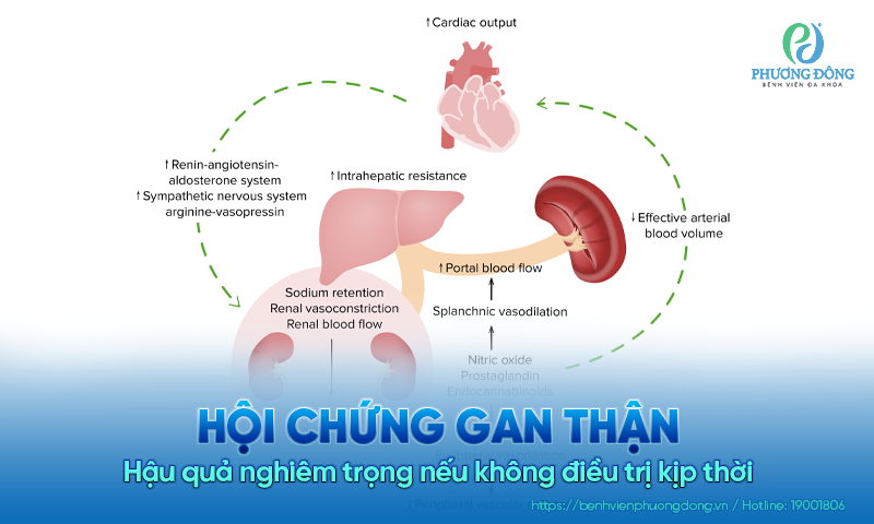 Hội chứng gan thận – Hậu quả nghiêm trọng nếu không điều trị kịp thời