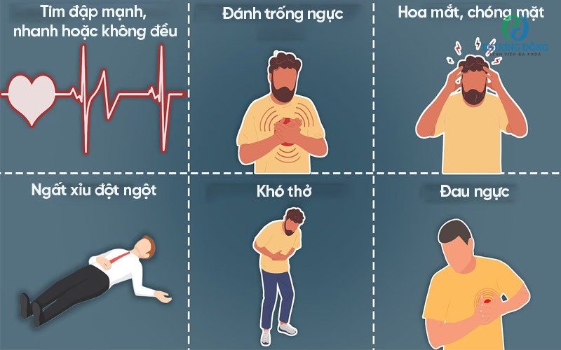 Các triệu chứng điển hình của hội chứng QT kéo dài