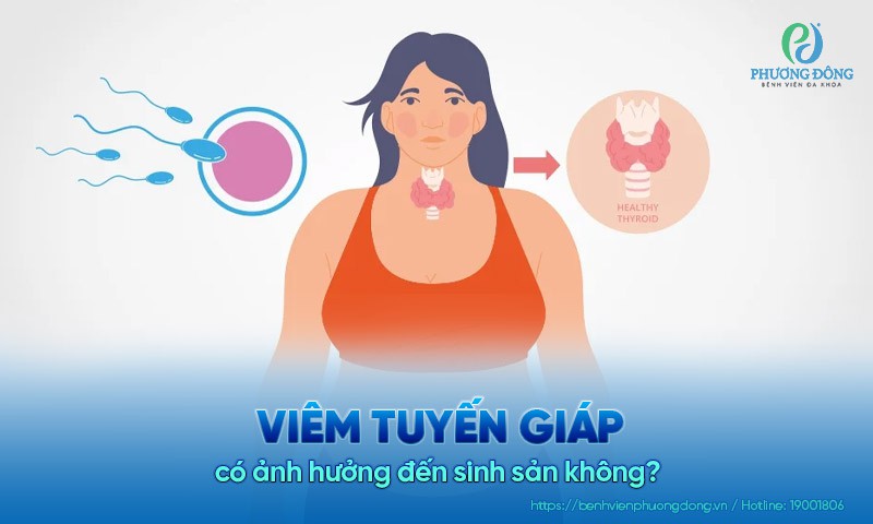 Viêm tuyến giáp có ảnh hưởng đến sinh sản không?