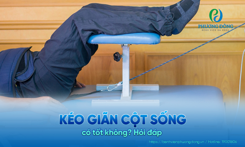 Hỏi đáp: Kéo giãn cột sống có tốt không? Hỏi đáp: Kéo giãn cột sống có tốt không?