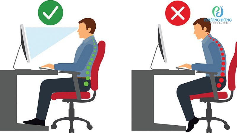 Điều chỉnh lấy lại đường cong sinh lý cột sống sổ