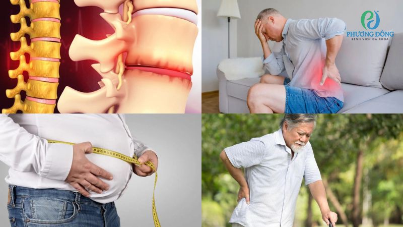 Đa dạng nguyên nhân khiến đường cong cột sống thắt lưng bị thay đổi
