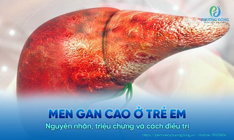 Men gan cao ở trẻ em: Nguyên nhân, triệu chứng và cách điều trị