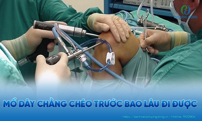 Mổ dây chằng chéo trước bao lâu đi được? Lưu ý giúp phục hồi hiệu quả Mổ dây chằng chéo trước bao lâu đi được? Lưu ý giúp phục hồi hiệu quả