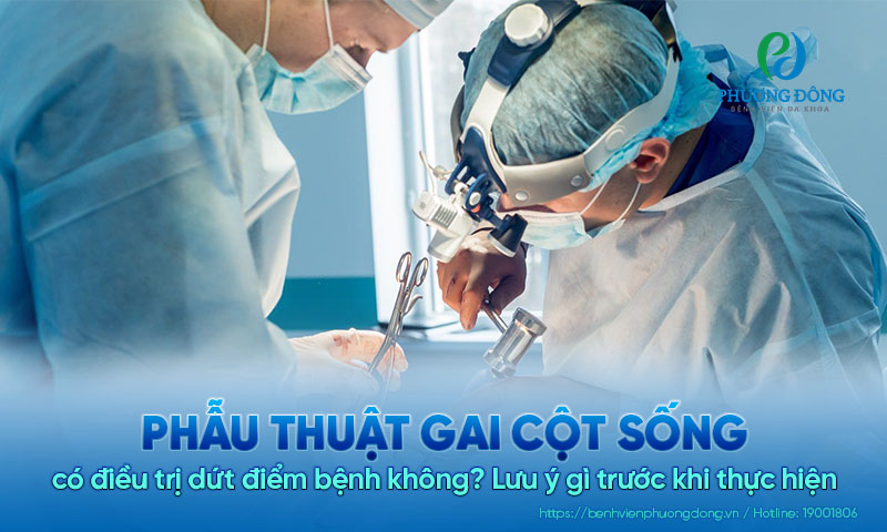 Phẫu thuật gai cột sống có điều trị dứt điểm bệnh không? Lưu ý gì trước khi thực hiện Phẫu thuật gai cột sống có điều trị dứt điểm bệnh không? Lưu ý gì trước khi thực hiện