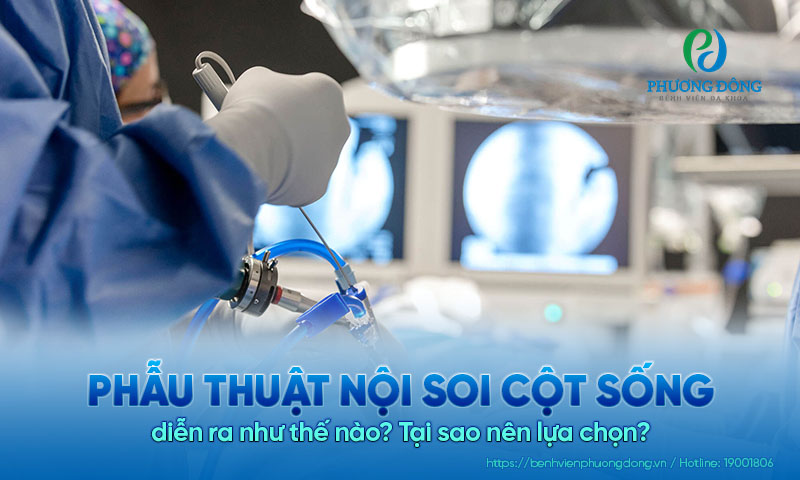 Phẫu thuật nội soi cột sống diễn ra như thế nào? Tại sao nên lựa chọn?