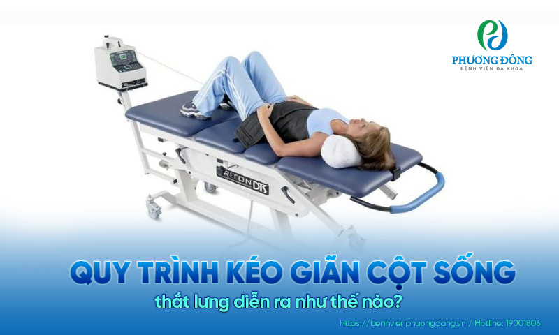 Quy trình kéo giãn cột sống thắt lưng diễn ra như thế nào?