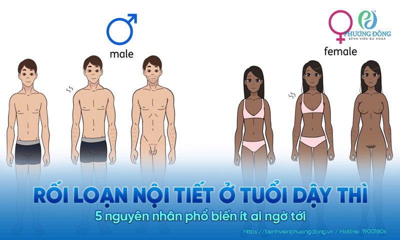Rối loạn nội tiết ở tuổi dậy thì: 5 nguyên nhân phổ biến ít ai ngờ tới Rối loạn nội tiết ở tuổi dậy thì: 5 nguyên nhân phổ biến ít ai ngờ tới