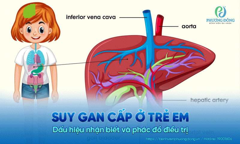 Suy gan cấp ở trẻ em: Dấu hiệu nhận biết và phác đồ điều trị