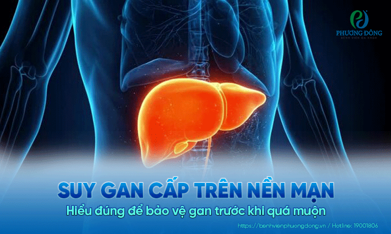 Suy gan cấp trên nền mạn là gì? Hiểu đúng để bảo vệ gan trước khi quá muộn