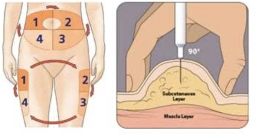 Tiêm insulin đúng cách- Chìa khoá kiểm soát đường huyết an toàn Tiêm insulin đúng cách- Chìa khoá kiểm soát đường huyết an toàn