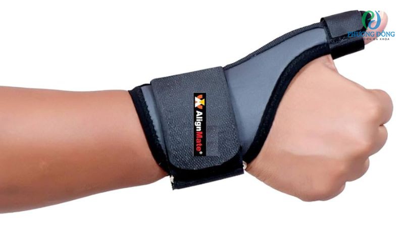 Phương pháp điều trị bảo tồn gân duỗi ngón cái