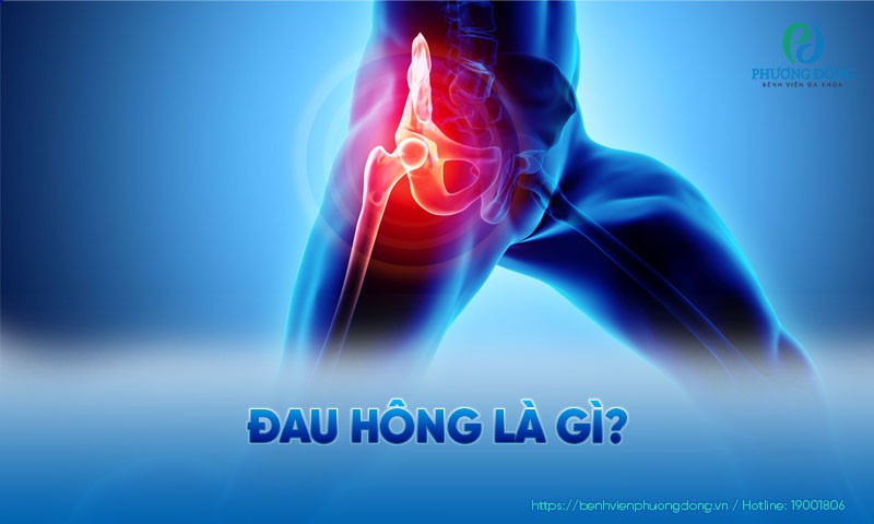 Đau hông: Nguyên nhân, triệu chứng và hướng điều trị