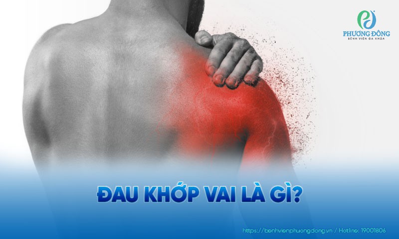 Đau khớp vai: Nguyên nhân, chẩn đoán và điều trị