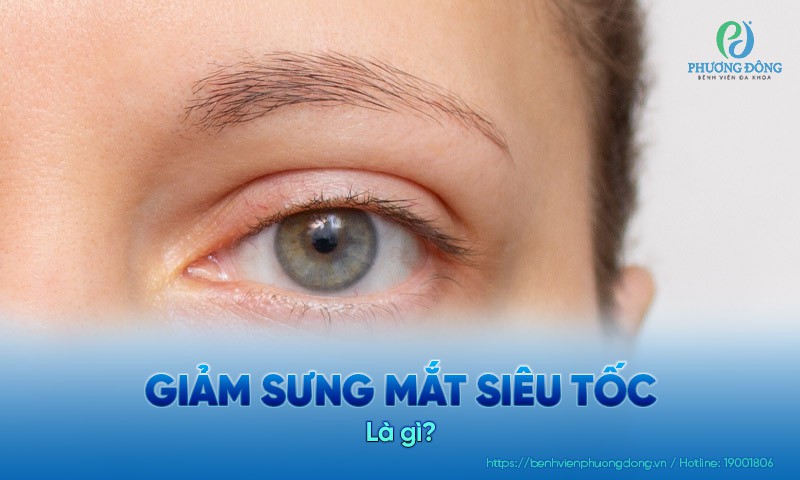 8 cách giảm sưng mắt siêu tốc tại nhà an toàn và hiệu quả