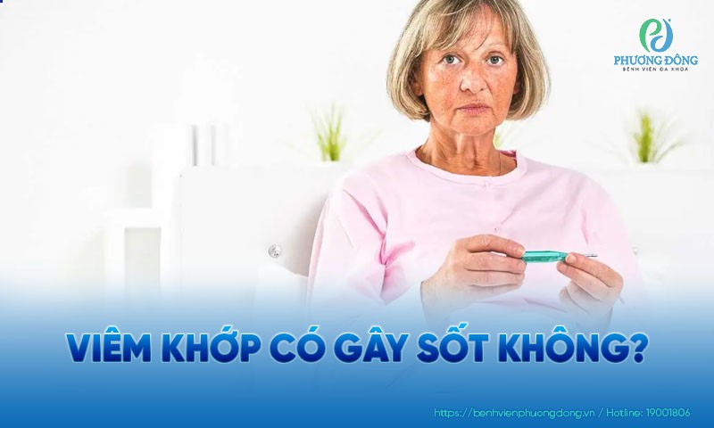 Viêm khớp có gây sốt không? Triệu chứng đi kèm và cách cải thiện