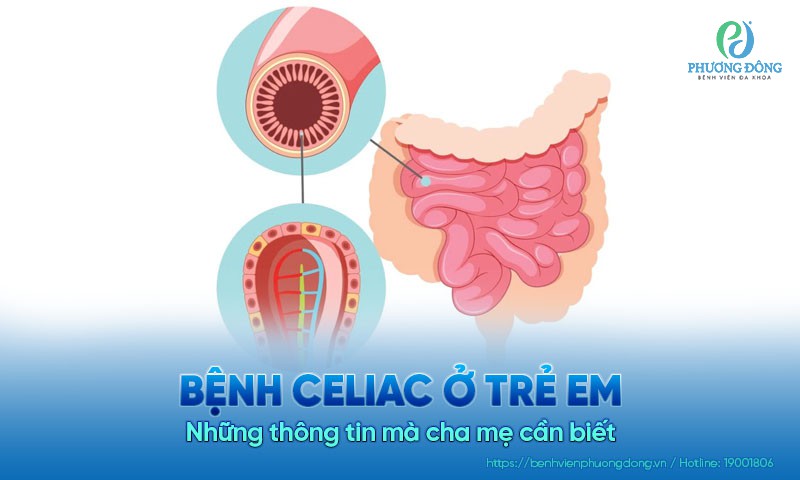 Bệnh Celiac ở trẻ em: Những thông tin mà cha mẹ cần biết