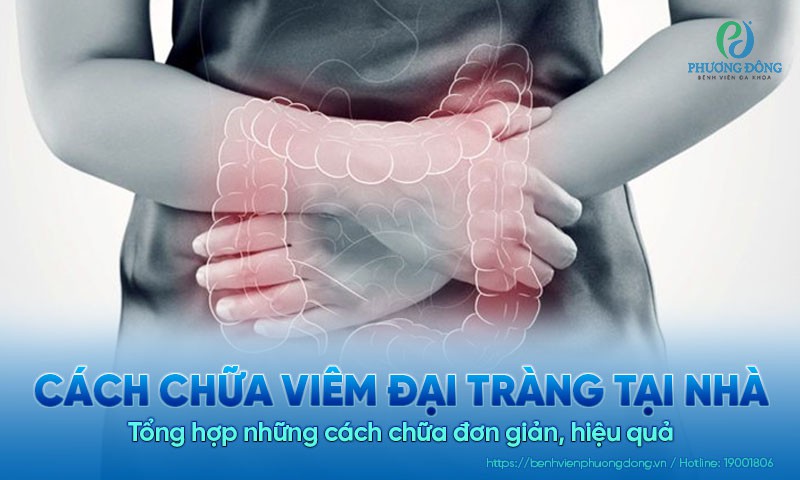 Tổng hợp những cách chữa viêm đại tràng tại nhà hiệu quả