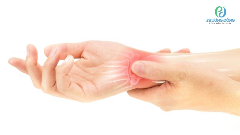 Chấn thương cổ tay khi chơi cầu lông do không khởi động kỹ