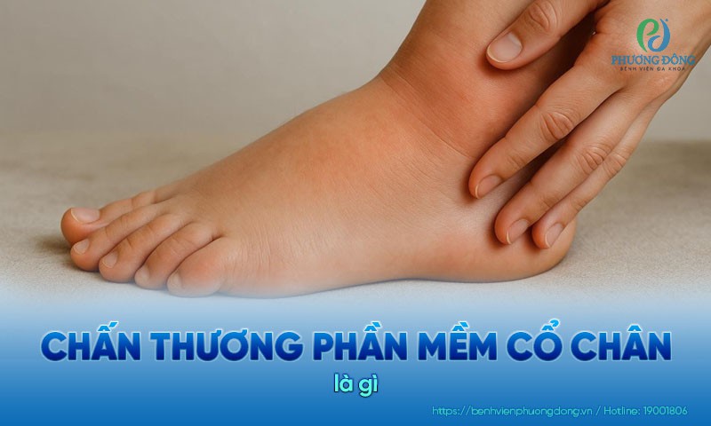 Chấn thương phần mềm cổ chân: Nguyên nhân, dấu hiệu và điều trị