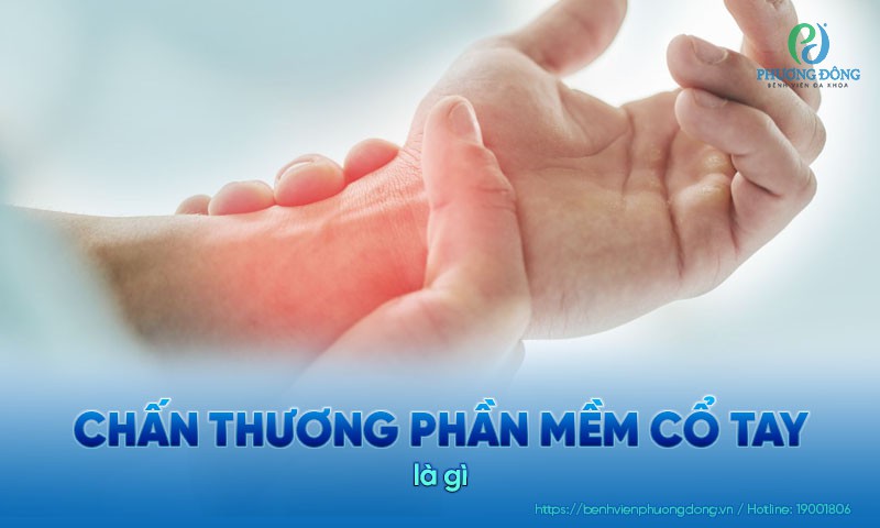 Chấn thương phần mềm cổ tay: Nguyên nhân, triệu chứng và điều trị