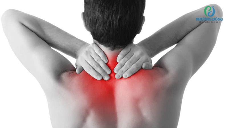 Căng cơ tập trung ảnh hưởng đến các phần mềm như cơ, dây chằng, gân