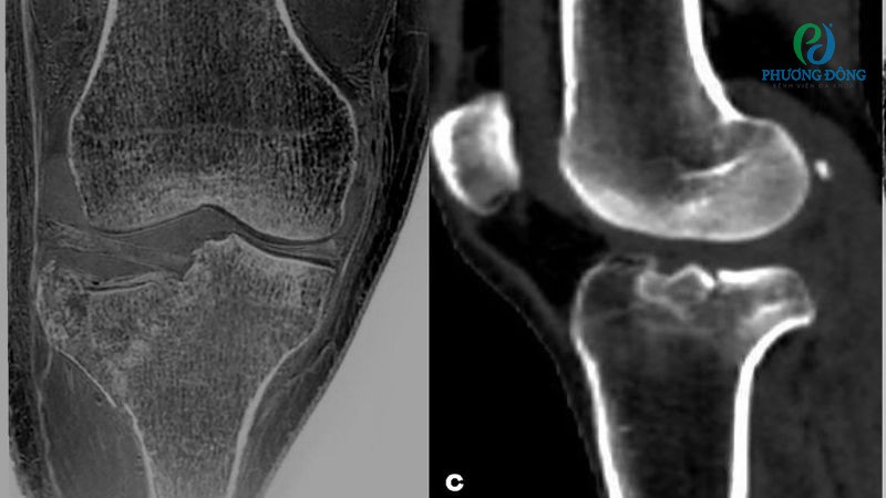 Các chỉ định cận lâm sàng thường được áp dụng trong chẩn đoán chấn thương