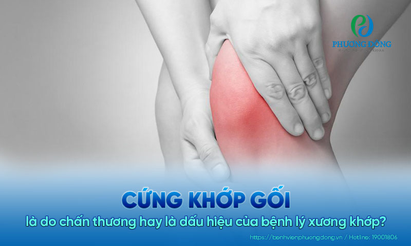 Cứng khớp gối là do chấn thương hay là dấu hiệu của bệnh lý xương khớp?