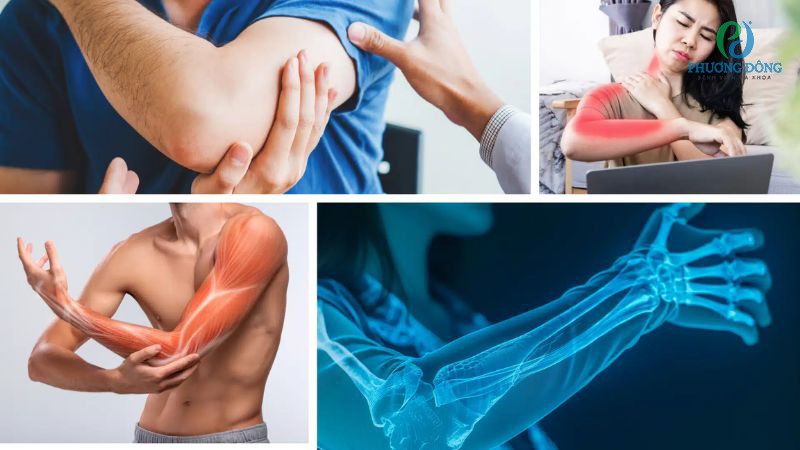 Các nhóm nguyên nhân làm khởi phát cơn đau nhức bên trong cánh tay