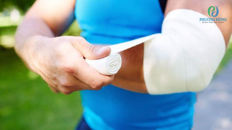 Các biện pháp thuyên giảm cơn đau buốt xương cánh tay tại nhà