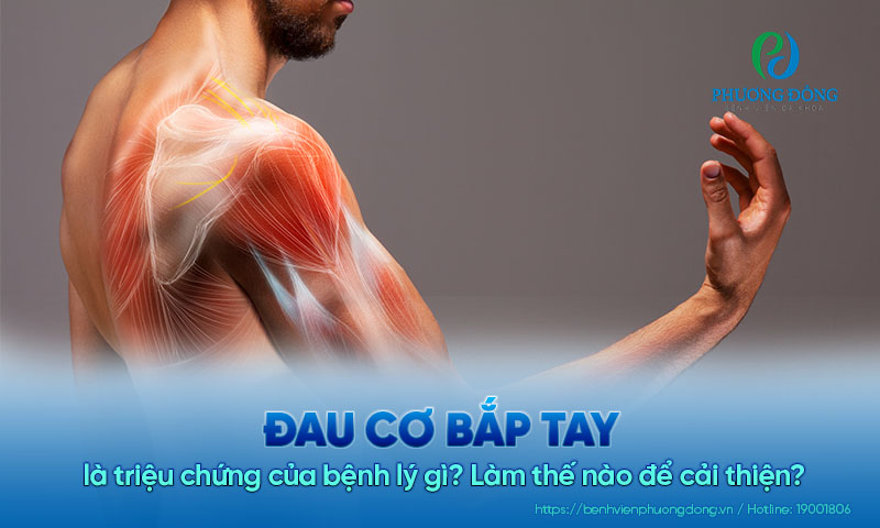 Đau cơ bắp tay là triệu chứng của bệnh lý gì? Làm thế nào để cải thiện?