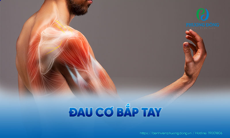 Bắp tay bị đau là triệu chứng khá phổ biến