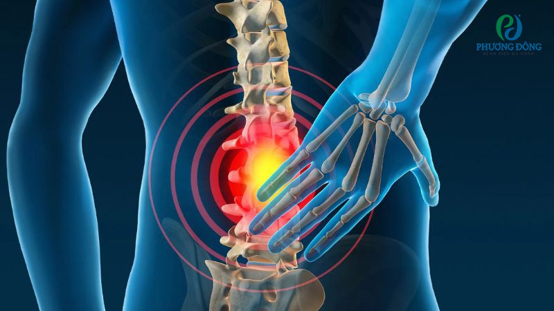 Tỷ lệ cơ liên sườn nhức mỏi tăng cao ở nhóm bệnh nhân xương khớp