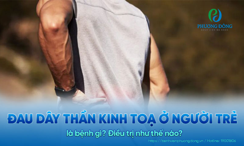 Đau thần kinh toạ ở người trẻ là bệnh gì? Điều trị như thế nào?