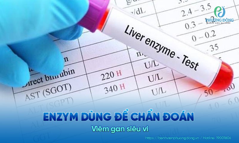 Enzym dùng để chẩn đoán viêm gan siêu vi