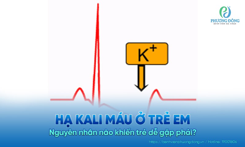 Hạ kali máu ở trẻ em: Nguyên nhân nào khiến trẻ dễ gặp phải?