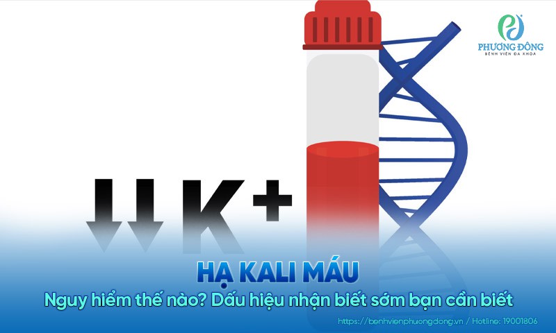 Hạ kali máu nguy hiểm thế nào? Dấu hiệu nhận biết sớm bạn cần biết