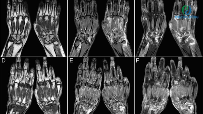 Phương pháp xét nghiệm, chẩn đoán nguyên nhân và mức độ chấn thương