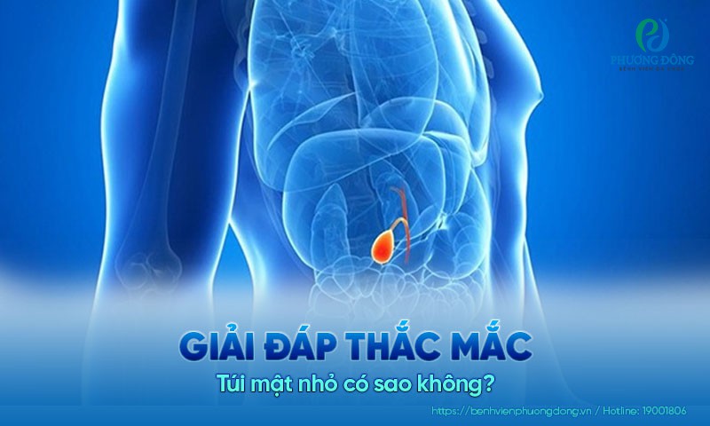 Túi mật nhỏ có sao không?